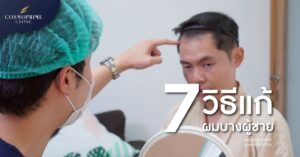 ผมบาง ผู้ชาย