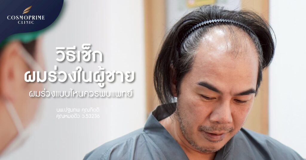 เช็กผมร่วงในผู้ชาย