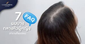 7 FAQ ผมบางกลางหัว ผู้หญิง