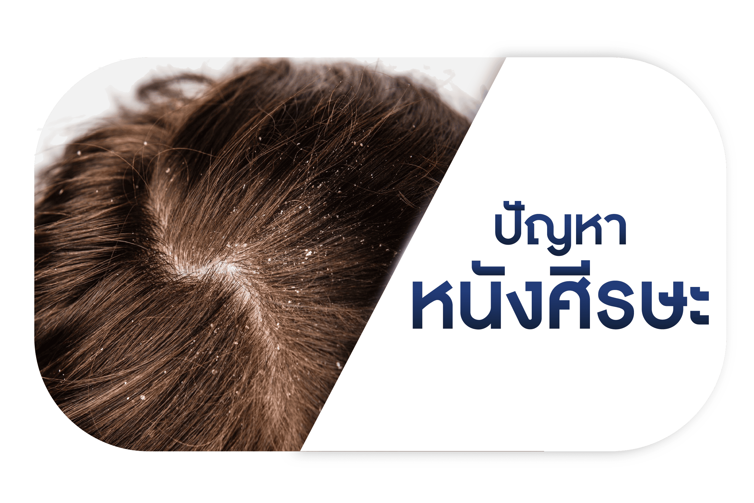 ปัญหาหนังศีรษะ