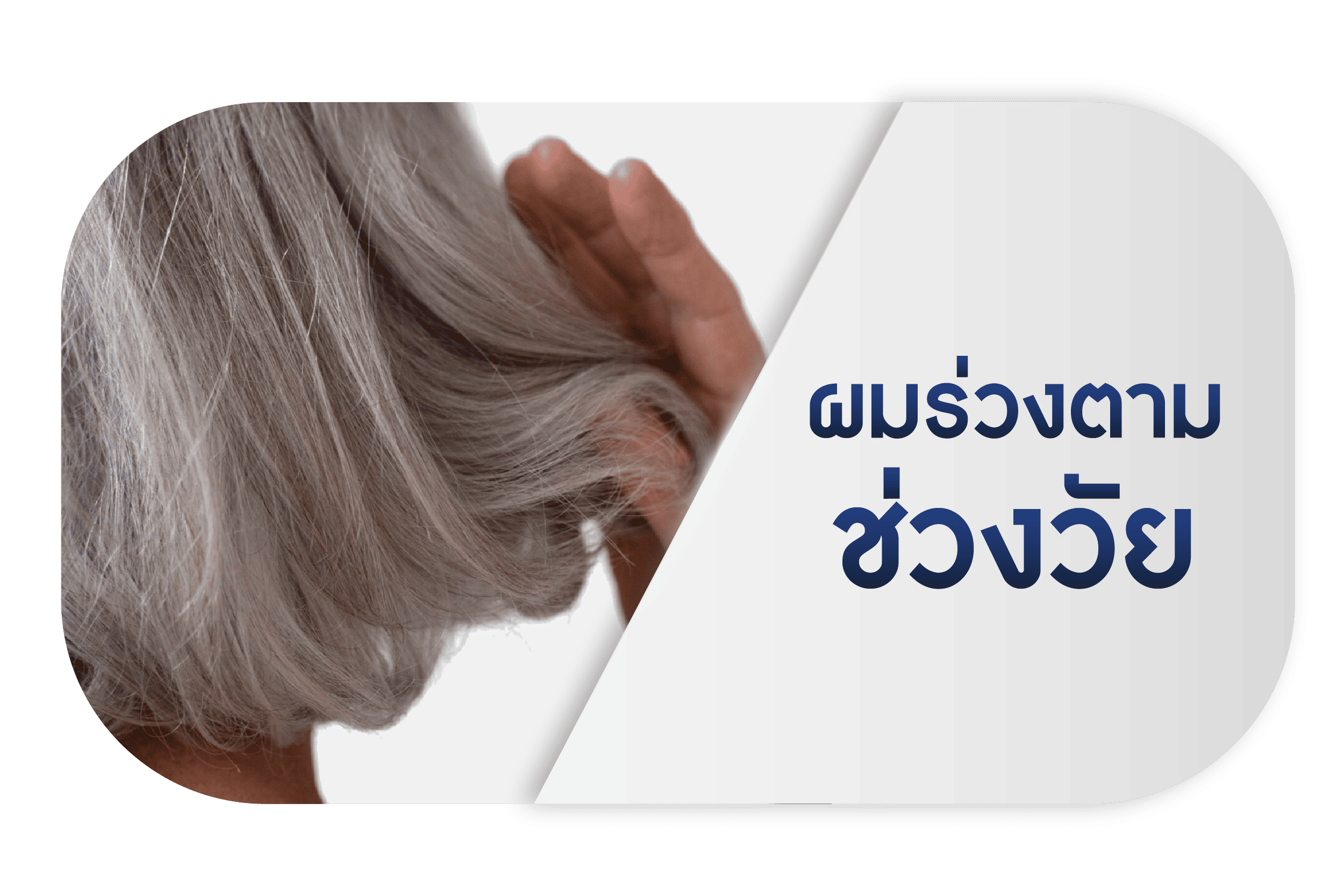 ผมร่วงตามช่วงวัย