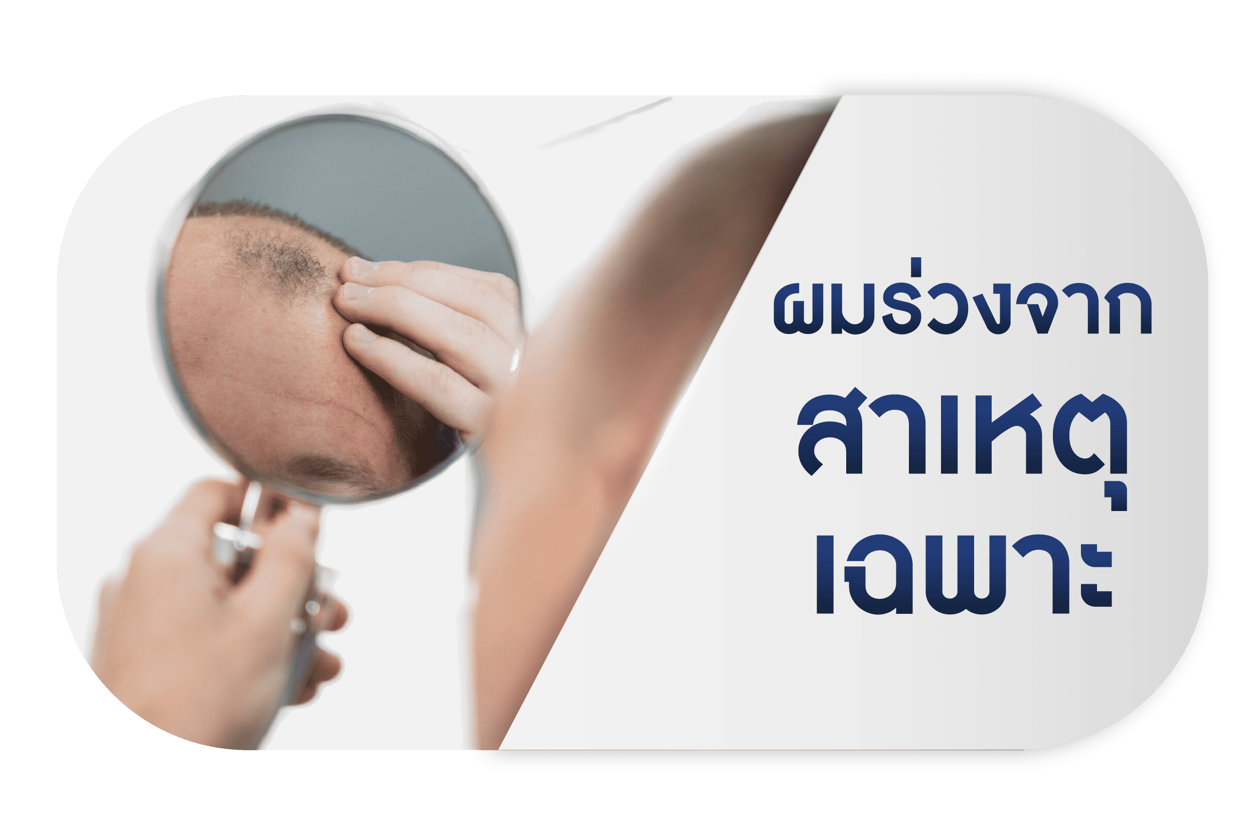 ผมร่วงจากสาเหตุเฉพาะ