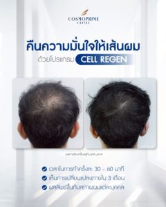 การทำ Cell Regen
