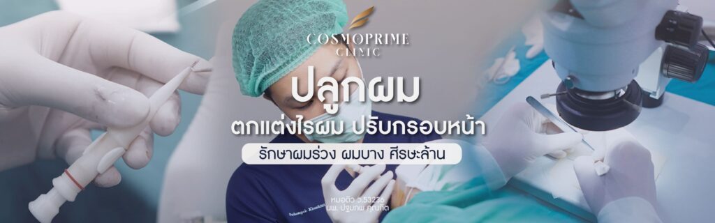 ปลูกผมคืออะไร