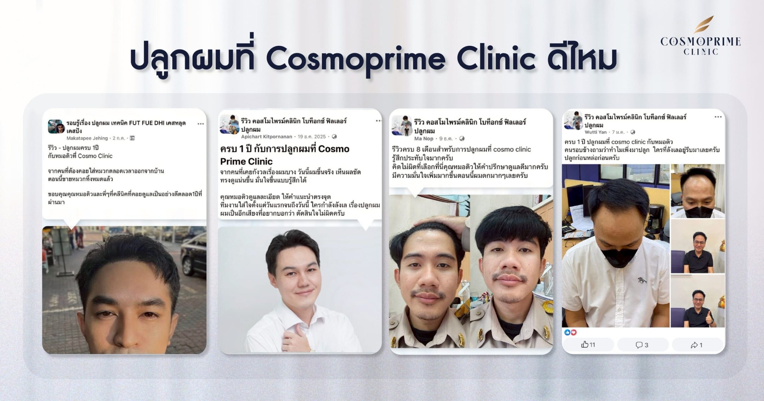 ปลูกผมที่ Cosmoprime Clinic ดีไหม