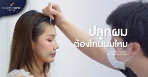 ปลูกผม ต้องโกนไหม และ โกนไม่โกน มีความแตกต่างกันยังไง ?