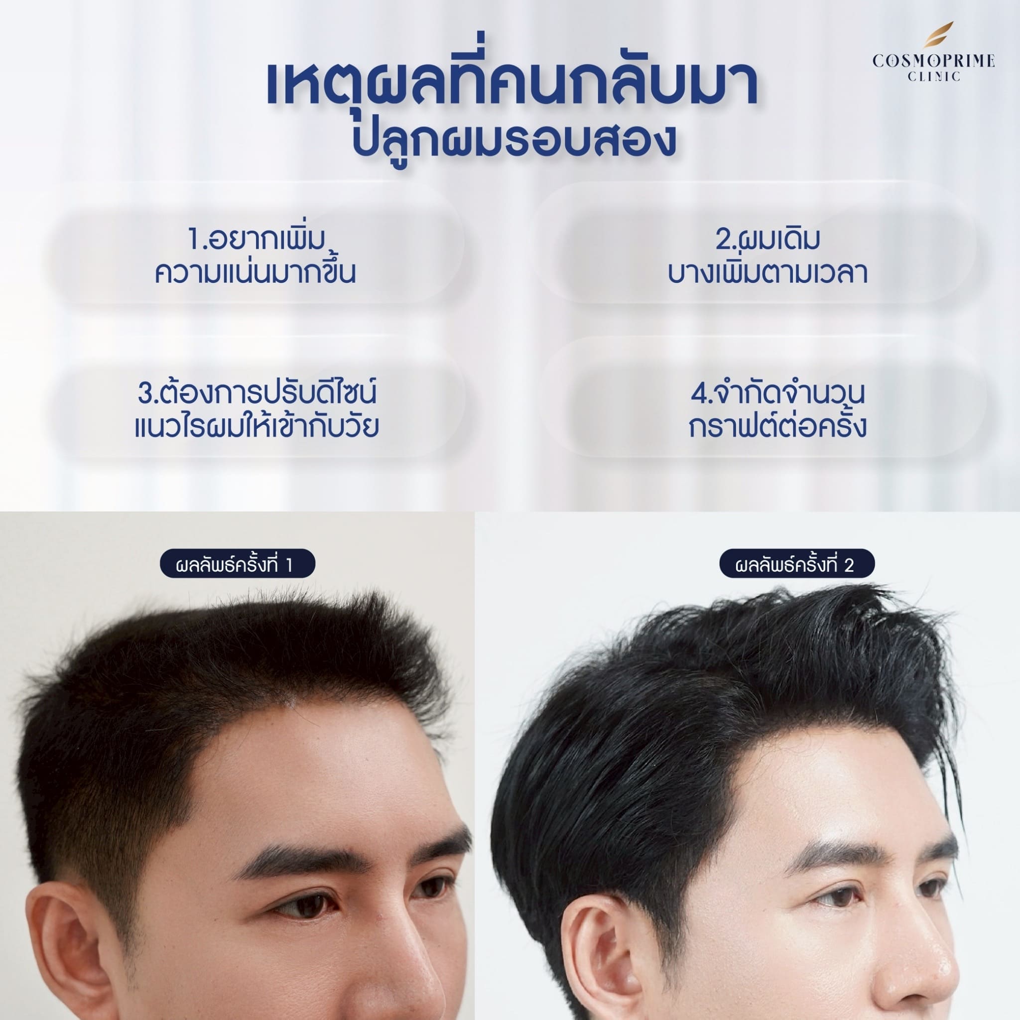 ทำไมถึงต้องปลูกผมรอบที่สอง ?
