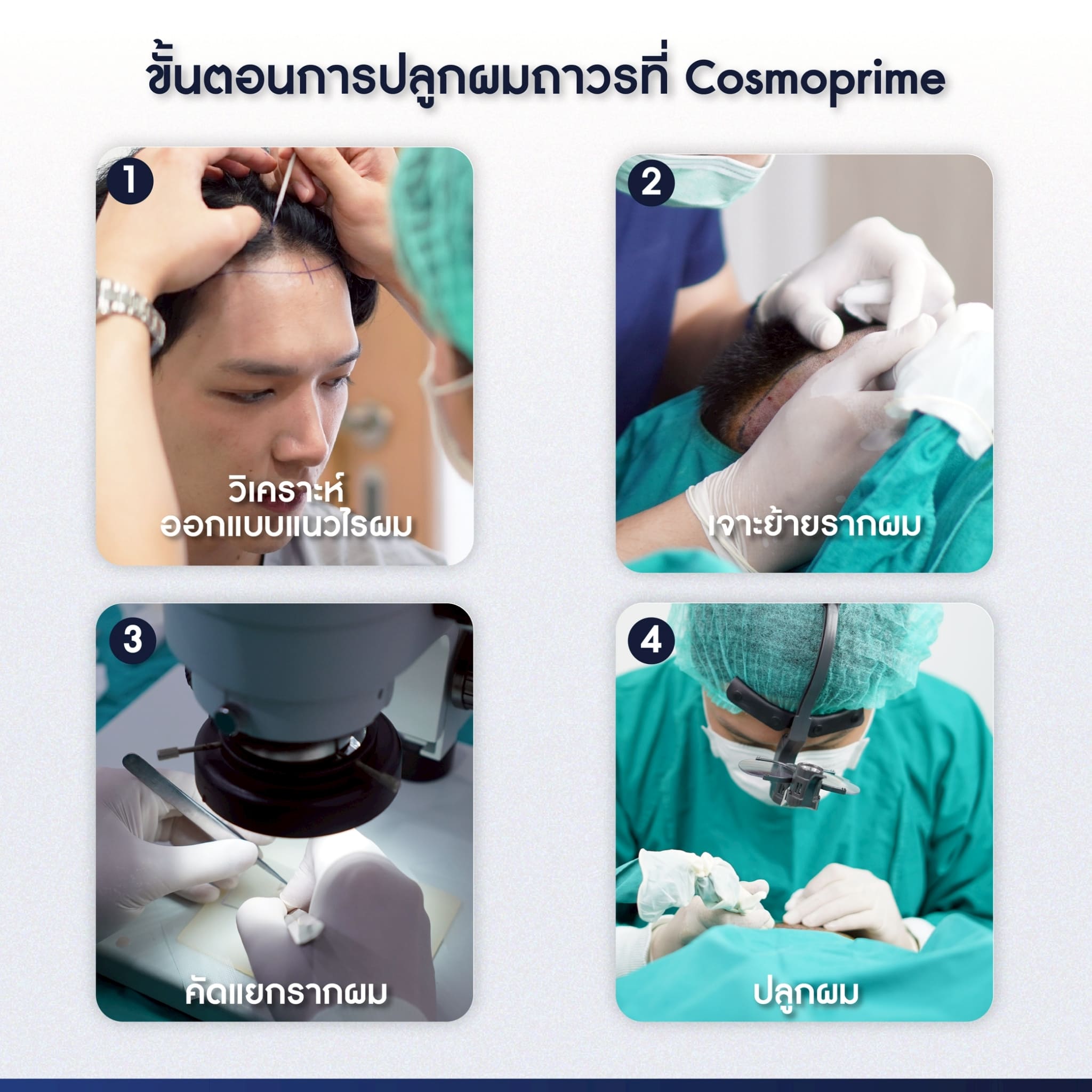 ขั้นตอนการปลูกผม