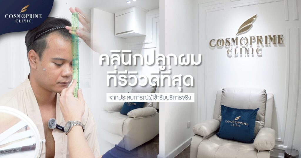 ปลูกผมที่รีวิวดีที่สุด