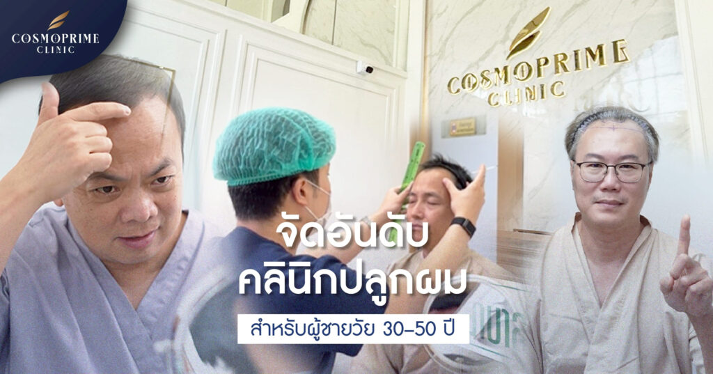 อันดับคลินิกปลูกผม