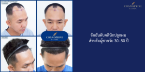 จัดอันดับคลินิกปลูกผม สำหรับผู้ชายวัย 30–50 ปี