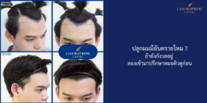 ปลูกผมมีอันตรายไหม