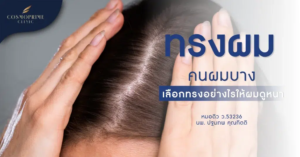 ทรงผมคนผมบาง